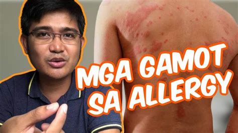 Gamot Sa Allergy Sa Balat, Anu.